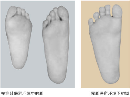 在穿鞋保育环境中的脚 赤脚保育环境下的脚